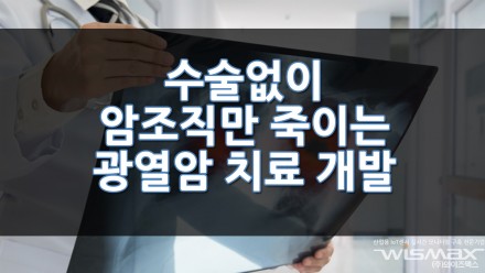 수술없이 암조직만 죽이는 광열암 치료모델 개발