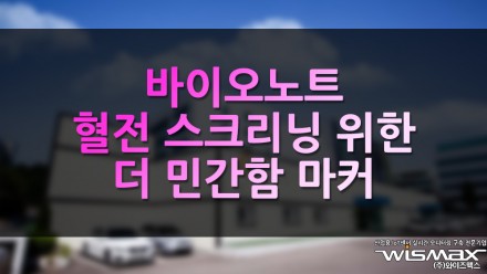 바이오노트 '혈전 스크리닝 위한 더 민감한 마커 D-dimer'